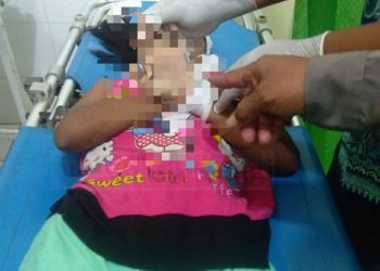 Hendak Menyetrika Bajunya Sendiri, Bocah Di Tulungagung Ini Tewas Kesetrum