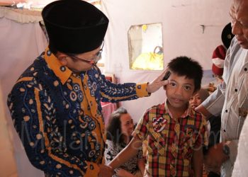 Terkendala Biaya Pengobatan, Ini yang Dilakukan Pemkot Malang