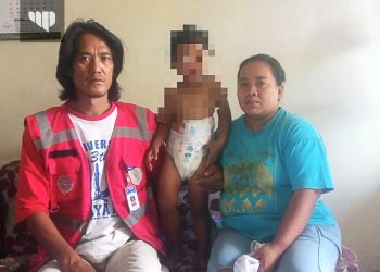 Balita 2,5 Tahun Ketergantungan Obat Pasca Operasi