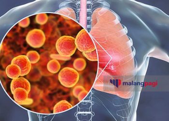 Dinkes Kota Batu Siapkan Strategi Antisipasi Penyebaran Pneuomonia